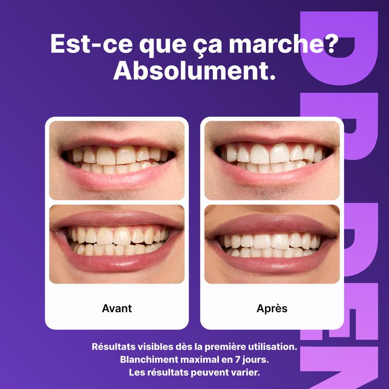 Bandes Blanchissantes Violettes pour les Dents